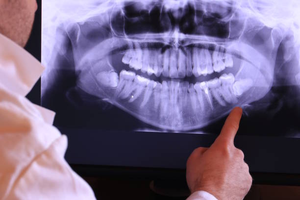 Best Emergency Treatment for Toothache in Abaster, AL